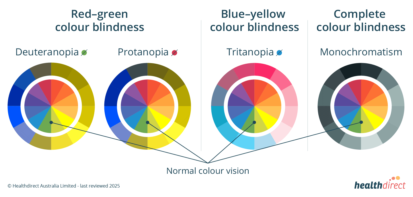Types of colorblindness examples